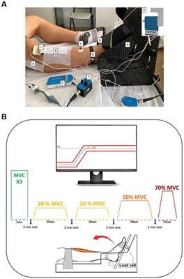 Sex-differences in the longitudinal recovery of neuromuscular function in COVID-19 associated acute respiratory distress syndrome survivors